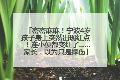 密密麻麻！宁波4岁孩子身上突然出现红点！连小便都变红了……家长：以为只是摔伤